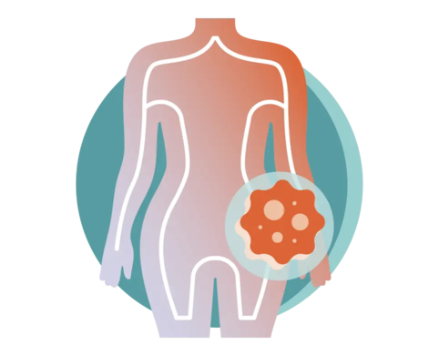 An illustration graphic of the human body with a human cell